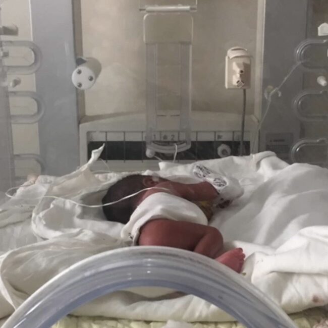 New Neonatal Unit at Alma Mater Hospital